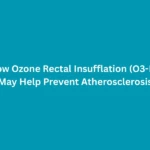 How Ozone Rectal Insufflation O3-RI May Help Prevent Atherosclerosis